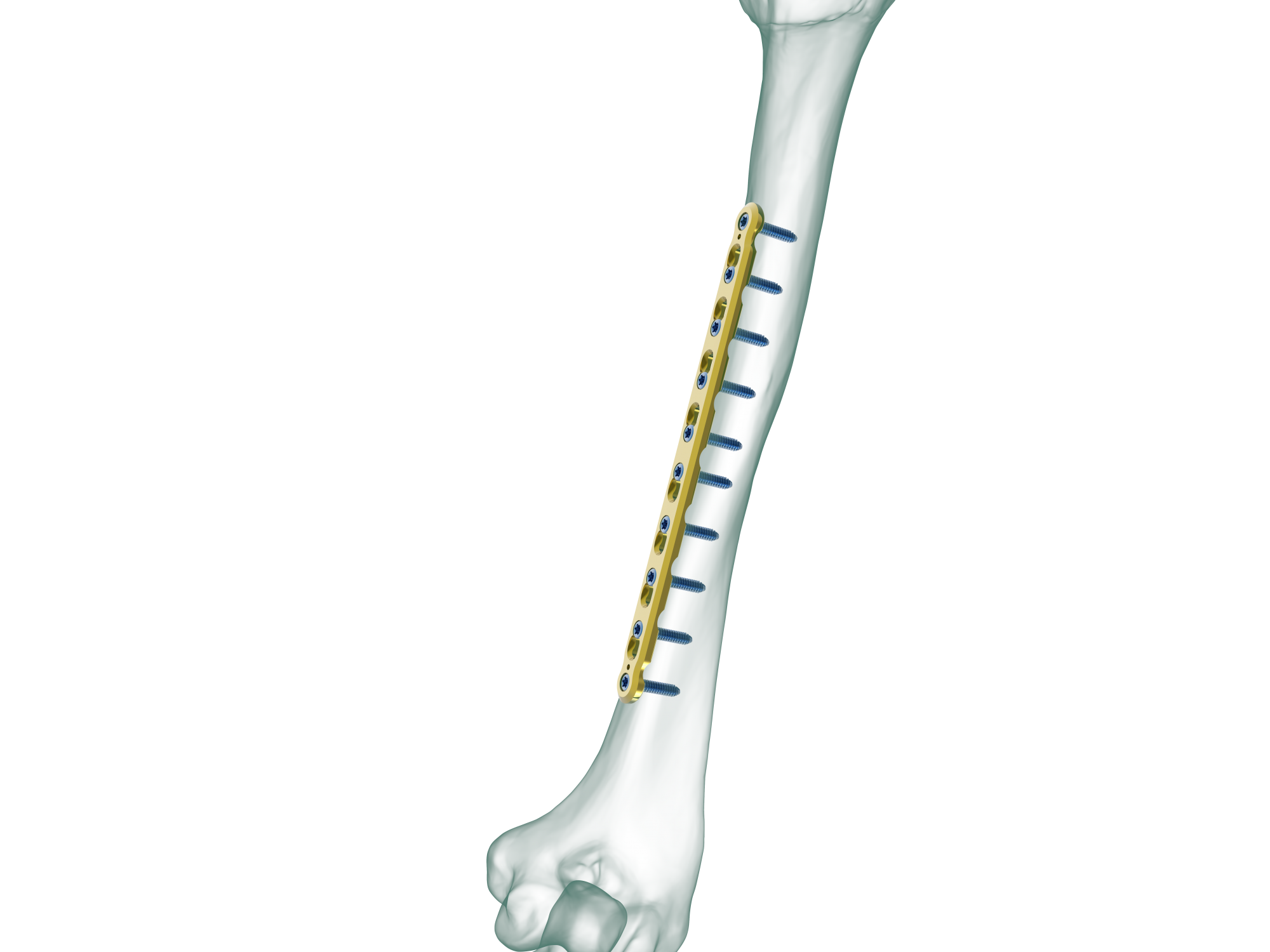 humerus-5